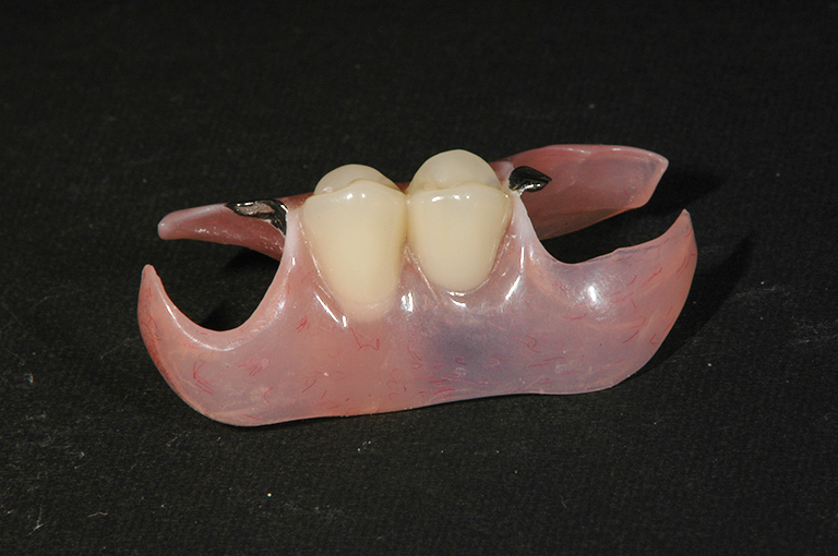 川本歯科医院　ノンクラスプ