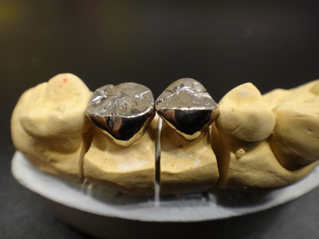 金属パラジウム合金使用 FMC